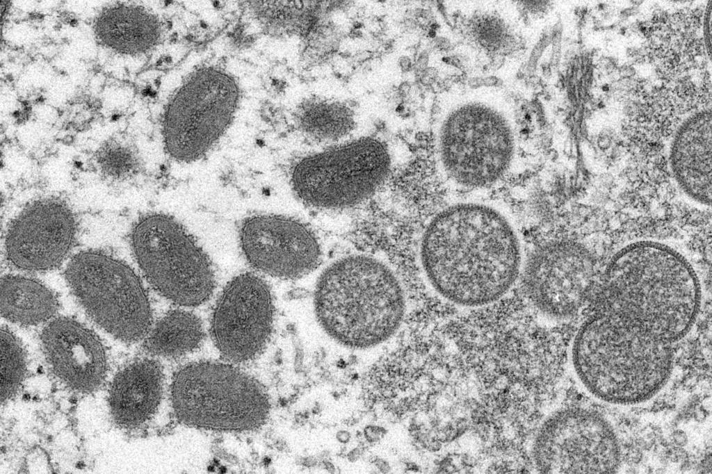 Portugal_Monkeypox402313871027_TASR.jpg