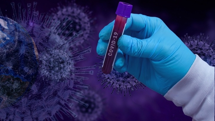 vkoronavirus-covid-virus-pixabay