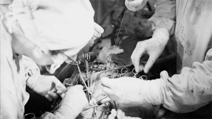 prvá transplantácia srdca v bývalom Československu_TASR.jpg